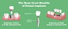 The Many Great Benefits of Dental Implants
