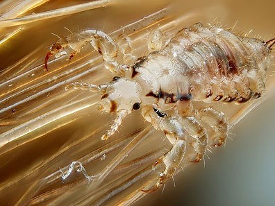Get Cost Effective Mobile Head Lice Removal Georgia