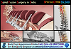 Call Us Now to get Online Appointment for Spinal Fusion Surgery in India by skilled Surgeons