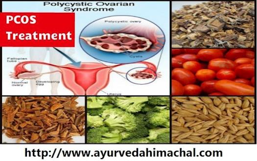 PCOS Ayurvedic Treatment Visit : http://www.ayurvedahimachal.com/pure-herbal-products/#sthash.a9eHh1