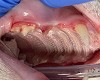 Treatment of Feline Stomatitis Disease At Veterinary Dental Care