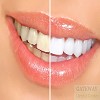 Teeth Whitening Clinic in Singapore