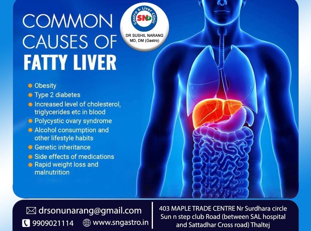 Common Causes of Fatty Liver!!