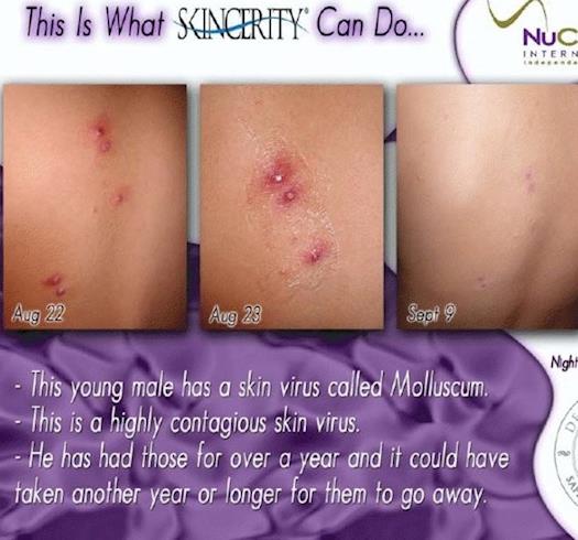 Sincerity Addresses Damaged Sk