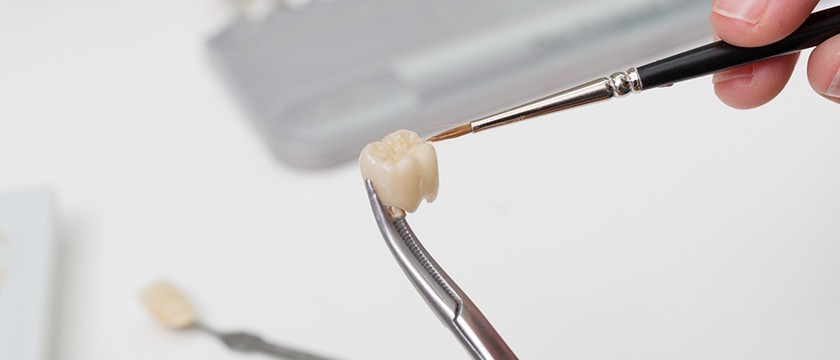 A Comprehensive Guide to Dental Crowns