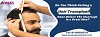 Consult With Hair Doctor in Ahmedabad Hair Transplant is Great Before Marriage