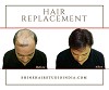 Hair Replacement Service