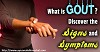 Know About Gouty Arthritis and Ayurvedic Treatment Visit : http://www.ayurvedahimachal.com/index.php