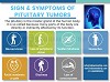 Sign & Symptoms of Pituitary Tumors