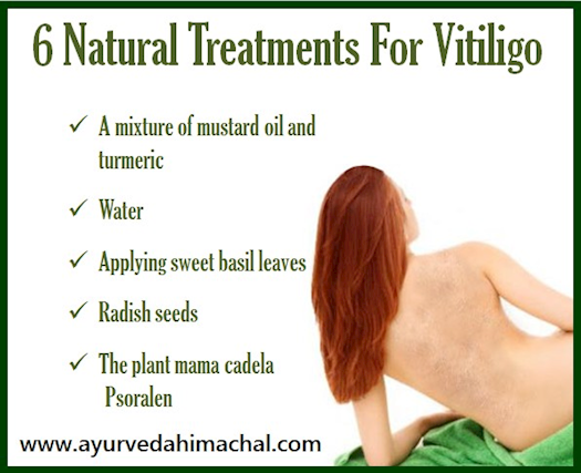 Treat Vitiligo with Arogyam Pure Herbs Kit For Vitiligo