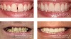 Triad Dentistry | Dental Implants Greensboro NC
