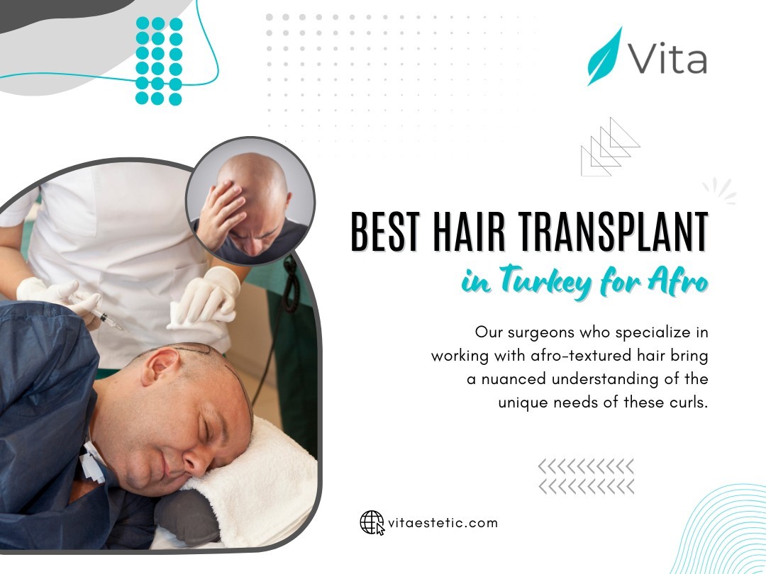 Best Hair Transplant in Turkey for Afro