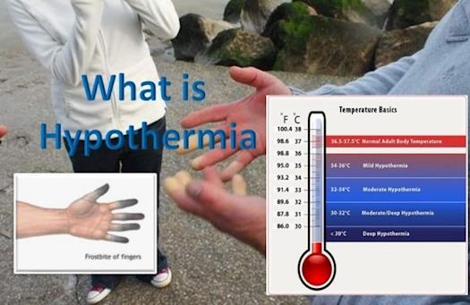 What is Hypothermia - Causes, Prevention and Treatment