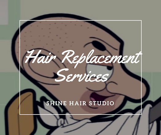 Hair Replacement Service 