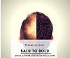 Baldness Service