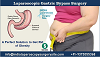 Laparoscopic Gastric Bypass Surgery : A Perfect Solution to Get Rid of Obesity