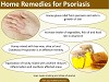 Home Remedies For Psoriasis