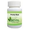 Prickly Heat Natural Treatment