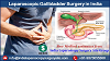 Lowest Cost of Laparoscopic Gallbladder Surgery in India: A Blessing for Medical Tourists