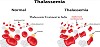 Thalassemia Treatment