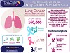 Free Consultation with the Best Lung Cancer Sprecialists in India