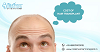 Want to Know More About Cost of #HairTransplant?