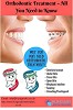 Give your Smile a Makeover with Orthodontic treatment