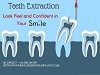 Tooth Extraction: Feel Free and Confident in Your Smile