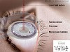 Best Lasik Eye Surgery Cost 