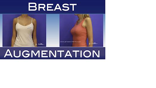 Breast Augmentation BodyCare