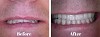 Desired Smiles: Visit Us and Makeover Your Smile