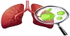 Does lung diseases run in families