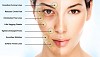 Make Your Self More Appealing: Choose Mesotherapy for Face