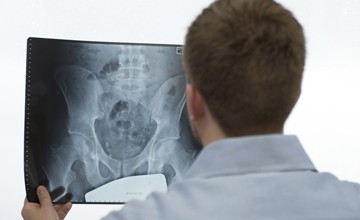 Learn About the Pain Management Interventions for Hip Fracture