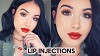 Best Lip Filler London | Lip Augmentation