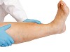 Is It Just Leg Pain Or Is It Peripheral Artery Disease?