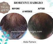 Unlock Your Hair's Potential with BioRevive HairGro