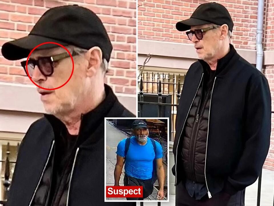 Steve Buscemi spotted with black eye, swollen face after random NYC attack 